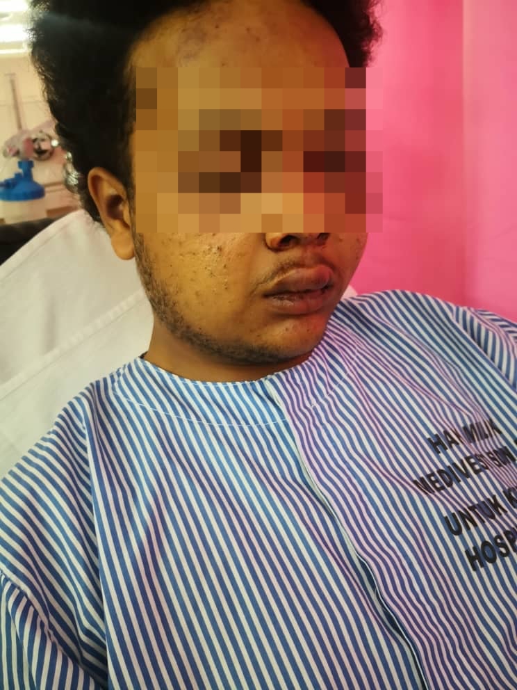 Pelaku Silap Orang